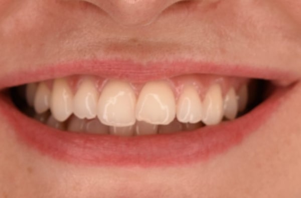 Before - Halo Dental
