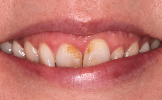 Before - Halo Dental