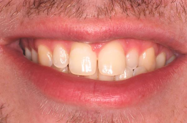 Before - Halo Dental