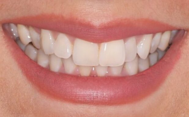 Before - Halo Dental