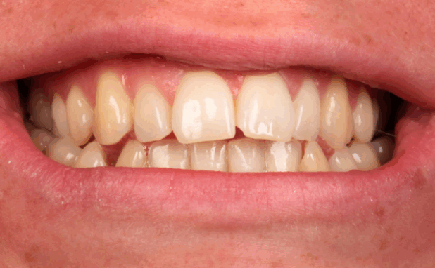 Before - Halo Dental