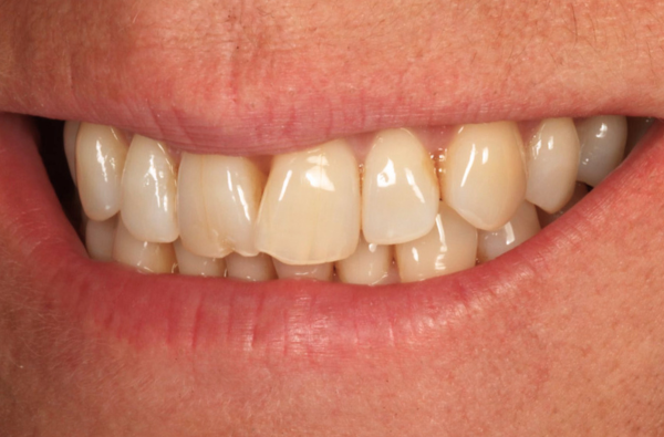 Before - Halo Dental