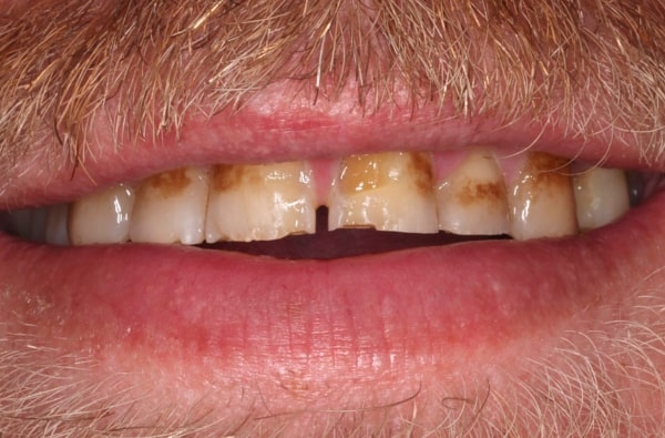 Before - Halo Dental