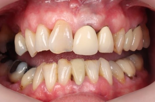 Before - Halo Dental